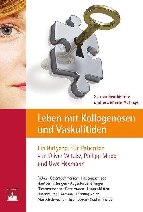 Cover for Witzke · Leben mit Kollagenosen und Vasku (Book)