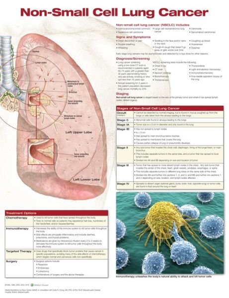 Cover for Anatomical Chart Company · Non-Small Cell Lung Cancer (Map) (2017)