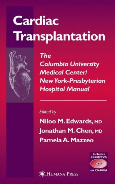 Cover for Niloo M Edwards · Cardiac Transplantation: The Columbia University Medical Center / New York-Presbyterian Hospital Manual - Contemporary Cardiology (Paperback Bog) [Softcover reprint of the original 1st ed. 2004 edition] (2012)