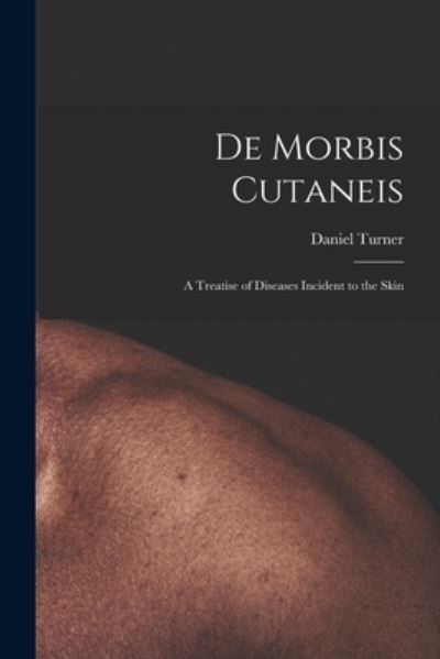 Cover for Daniel 1667-1741 Turner · De Morbis Cutaneis (Paperback Book) (2021)