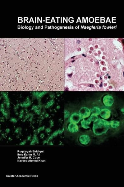 Cover for Ruqaiyyah Siddiqui · Brain-eating Amoebae: Biology and Pathogenesis of Naegleria Fowleri (Taschenbuch) (2016)