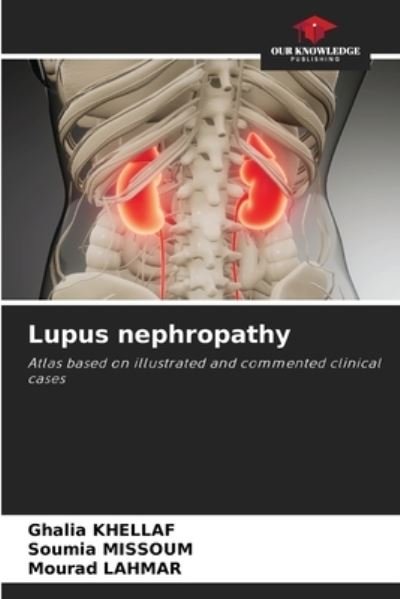 Cover for Ghalia Khellaf · Lupus nephropathy (Paperback Book) (2021)