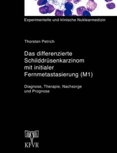 Cover for Thorsten Petrich · Das differenzierte Schilddrusenkarzinom mit initialer Fernmetastasierung (M1) (Paperback Book) [German edition] (2000)