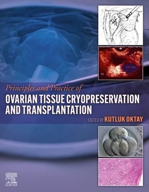 Cover for Kutluk Oktay · Principles and Practice of Ovarian Tissue Cryopreservation and Transplantation (Inbunden Bok) (2022)