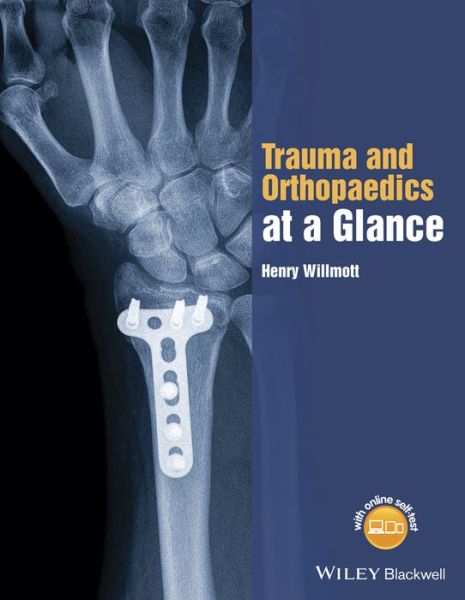 Cover for Willmott, Henry (East Sussex Healthcare NHS Trust) · Trauma and Orthopaedics at a Glance - At a Glance (Paperback Book) (2015)
