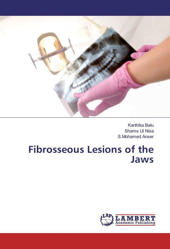 Cover for Balu · Fibrosseous Lesions of the Jaws (Book)