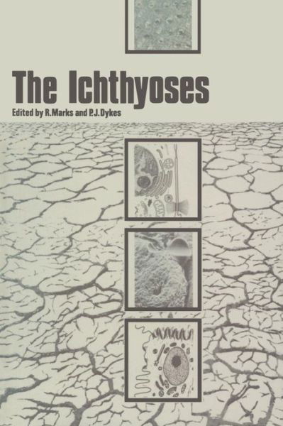 Cover for R Marks · The Ichthyoses: Proceedings of the 2nd Annual Clinically Orientated Symposium of The European Society for Dermatological Research (Paperback Bog) [Softcover reprint of the original 1st ed. 1978 edition] (2012)