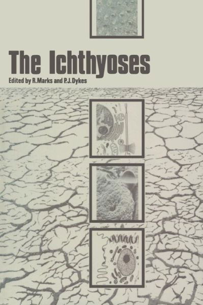 Cover for R Marks · The Ichthyoses: Proceedings of the 2nd Annual Clinically Orientated Symposium of The European Society for Dermatological Research (Paperback Book) [Softcover reprint of the original 1st ed. 1978 edition] (2012)