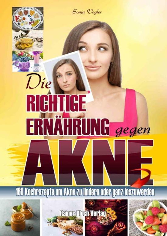 Cover for Vogler · Die richtige Ernährung gegen Akn (Book)