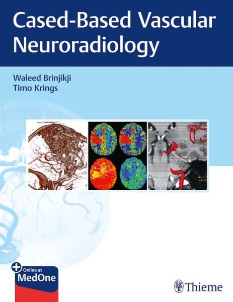 Cover for Waleed Brinjikji · Imaging in Neurovascular Disease: A Case-Based Approach (Buch) (2019)