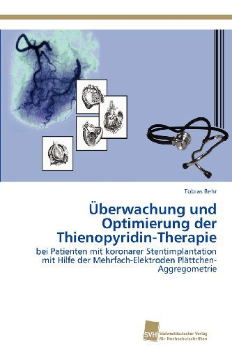 Cover for Tobias Behr · Überwachung Und Optimierung Der Thienopyridin-therapie: Bei Patienten Mit Koronarer Stentimplantation Mit Hilfe Der Mehrfach-elektroden Plättchen-aggregometrie (Paperback Book) [German edition] (2012)