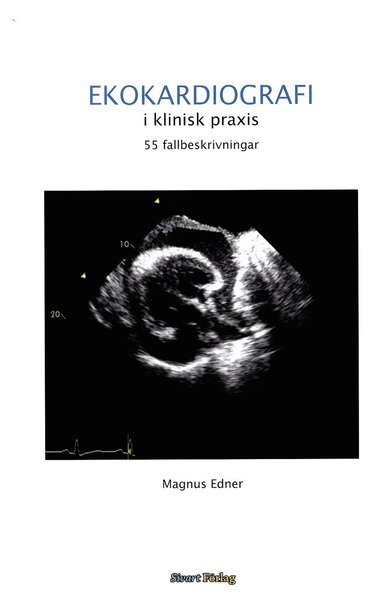 Cover for Magnus Edner · Ekokardiografi i klinisk praxis: 55 fallbeskrivningar (Bound Book) (2012)