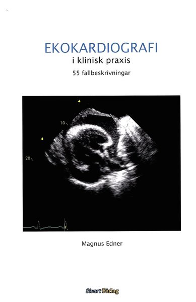 Ekokardiografi i klinisk praxis: 55 fallbeskrivningar - Magnus Edner - Książki - Sivart Förlag - 9789185705535 - 25 kwietnia 2012