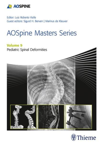 AOSpine Masters Series, Volume 9: Pediatric Spinal Deformities - AOSpine Masters Series - Luiz Vialle - Boeken - Thieme Medical Publishers Inc - 9781626234536 - 7 september 2017