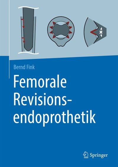 Cover for Fink · Femorale Revisionsendoprothetik (Buch) (2021)