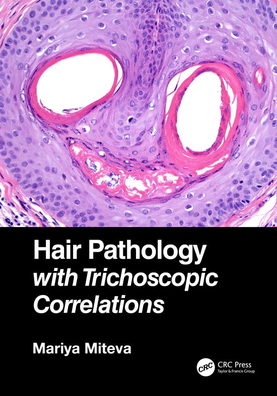 Cover for Mariya Miteva · Hair Pathology with Trichoscopic Correlations (Hardcover Book) (2021)