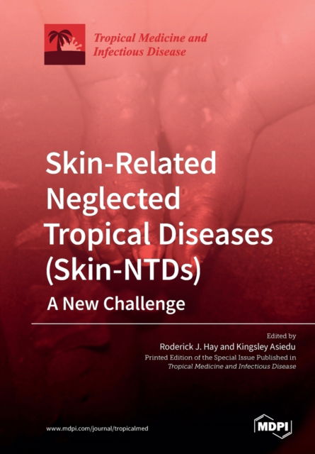 Cover for Roderick J Hay · Skin-Related Neglected Tropical Diseases (Skin-NTDs) A New Challenge (Paperback Book) (2019)