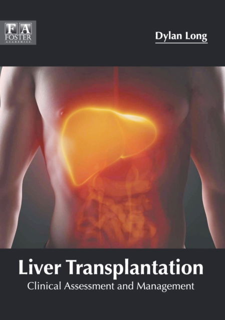 Cover for Dylan Long · Liver Transplantation: Clinical Assessment and Management (Hardcover Book) (2018)