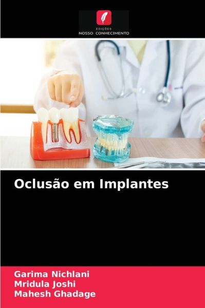Cover for Garima Nichlani · Oclusao em Implantes (Paperback Book) (2021)