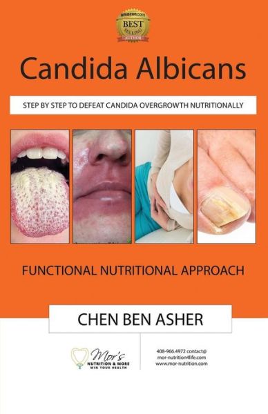 Cover for Chen Ben Asher · Candida Albicans (Paperback Book) (2018)