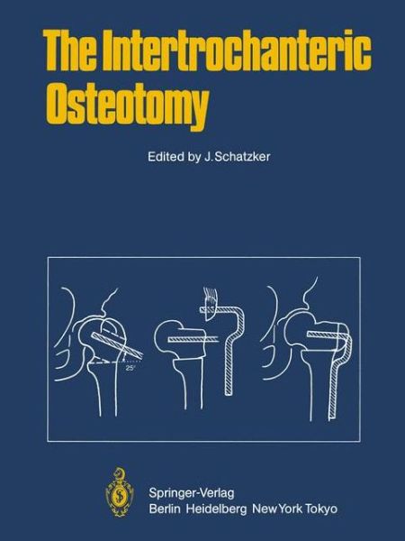 Cover for J Schatzker · The Intertrochanteric Osteotomy (Taschenbuch) [Softcover reprint of the original 1st ed. 1984 edition] (2012)