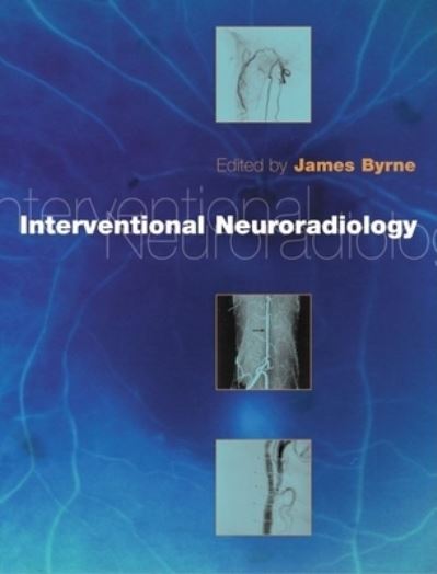 Cover for James Byrne · Interventional Neuroradiology (Hardcover Book) (2002)