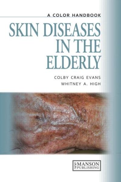 Cover for Colby Evans · Skin Diseases in the Elderly: A Color Handbook - Medical Color Handbook Series (Paperback Book) (2011)