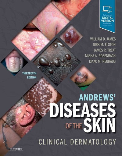 Cover for James · Andrews' Diseases of the Skin, International Edition : Clinical Dermatology (Pocketbok)