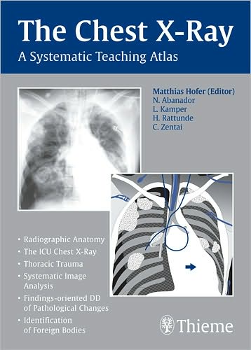 Cover for Matthias Hofer · The Chest X Ray (Paperback Book) (2007)