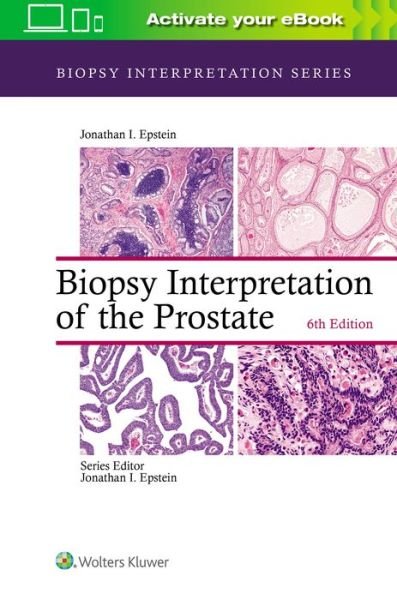 Cover for Jonathan I. Epstein · Biopsy Interpretation of the Prostate - Biopsy Interpretation Series (Hardcover Book) (2020)