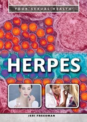 Cover for Jeri Freedman · Herpes (Hardcover Book) (2015)