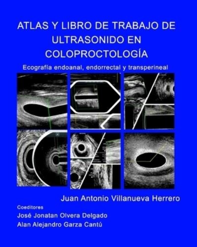 Cover for Juan a Villanueva Herrero · Atlas y Libro de Trabajo de Ultrasonido en Coloproctologia (Paperback Book) (2020)