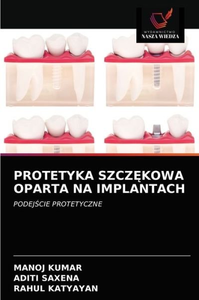 Cover for Manoj Kumar · Protetyka Szcz?kowa Oparta Na Implantach (Pocketbok) (2021)