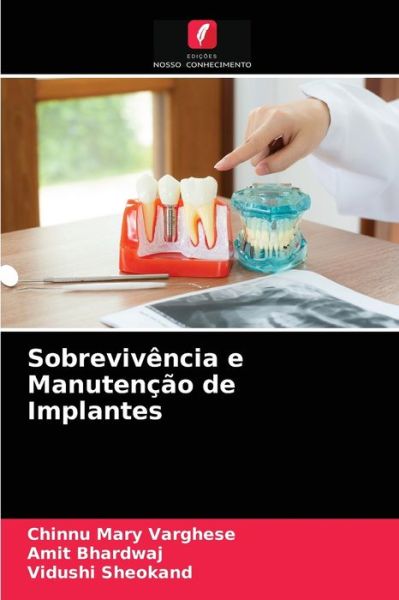 Cover for Chinnu Mary Varghese · Sobrevivencia e Manutencao de Implantes (Paperback Book) (2021)