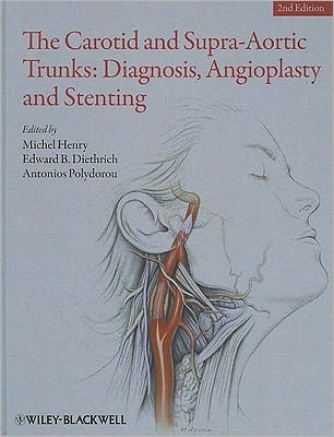 Cover for Michel Henry · The Carotid and Supra-Aortic Trunks: Diagnosis, Angioplasty and Stenting (Hardcover Book) (2011)