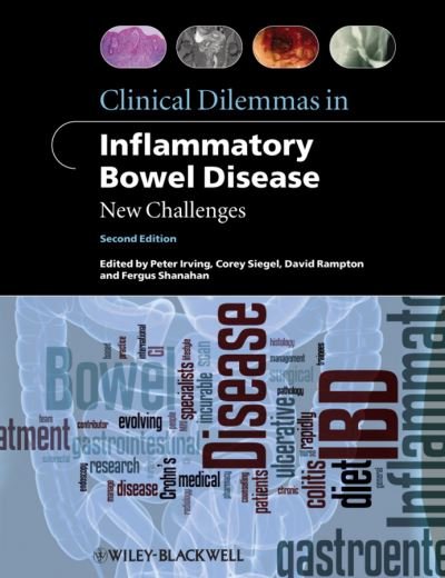 Clinical Dilemmas in Inflammatory Bowel Disease: New Challenges - PM Irving - Bücher - John Wiley and Sons Ltd - 9781444334548 - 11. November 2011