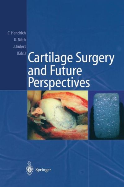 Cartilage Surgery and Future Perspectives - Christian Hendrich - Books - Springer-Verlag Berlin and Heidelberg Gm - 9783540010548 - April 28, 2003