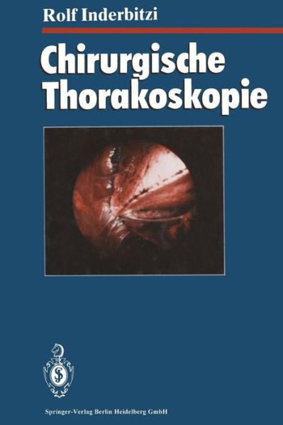 Cover for Rolf Gilbert Carl Inderbitzi · Chirurgische Thorakoskopie (Paperback Book) [Softcover Reprint of the Original 1st 1993 edition] (2013)