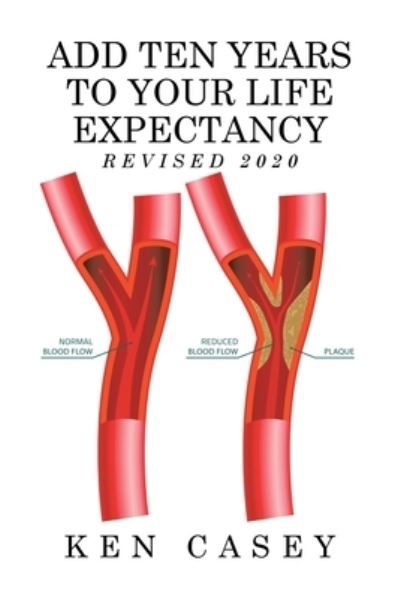 Cover for Ken Casey · Add Ten Years to Your Life Expectancy (Pocketbok) (2019)