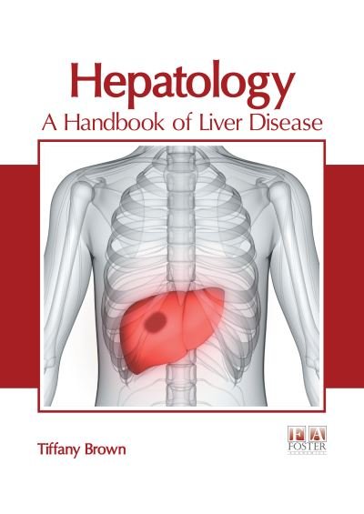 Cover for Tiffany Brown · Hepatology: A Handbook of Liver Disease (Hardcover Book) (2020)