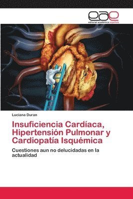Cover for Duran · Insuficiencia Cardíaca, Hipertens (Bok) (2018)