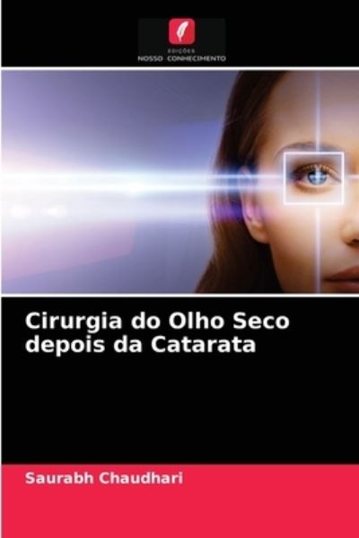 Cover for Saurabh Chaudhari · Cirurgia do Olho Seco depois da Catarata (Paperback Book) (2021)