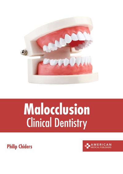 Cover for Philip Chiders · Malocclusion: Clinical Dentistry (Gebundenes Buch) (2022)