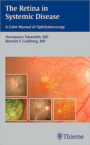 The Retina in Systemic Disease: A Color Manual of Ophthalmoscopy - Homayoun Tabandeh - Kirjat - Thieme Medical Publishers Inc - 9781604060553 - sunnuntai 1. marraskuuta 2009