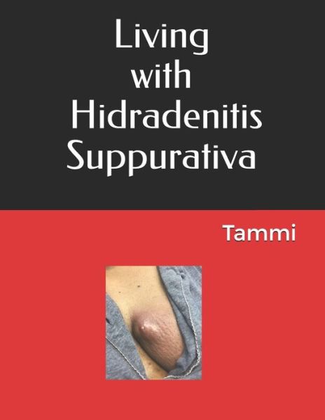 Cover for Tammi Johnson · Living with Hidradenitis Suppurativa (Paperback Book) (2018)