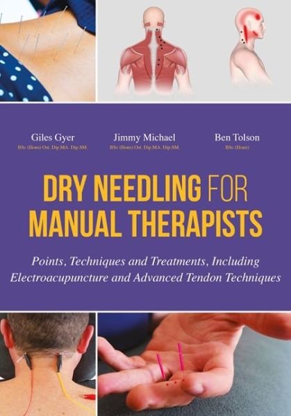 Cover for Giles Gyer · Dry Needling for Manual Therapists: Points, Techniques and Treatments, Including Electroacupuncture and Advanced Tendon Techniques (Hardcover Book) (2016)