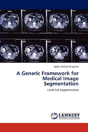 Cover for Agam Adityas Nugroho · A Generic Framework for Medical Image Segmentation: Level Set Segmentation (Paperback Book) (2012)