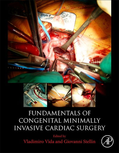 Cover for Vida, Vladimiro (Pediatric Cardiac Surgery Unit, University of Padua Medical School, Italy) · Fundamentals of Congenital Minimally Invasive Cardiac Surgery (Taschenbuch) (2018)