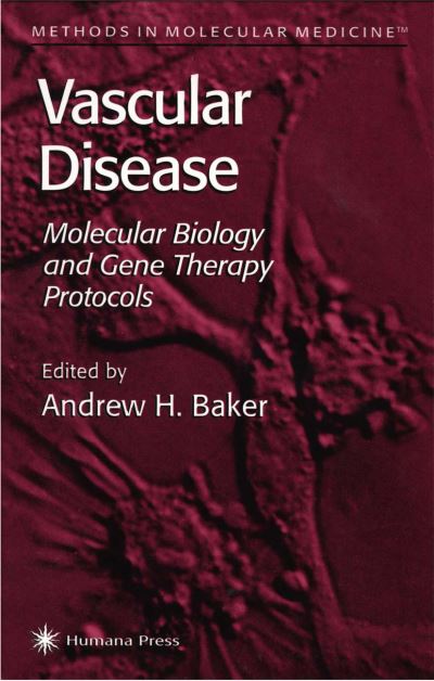 Cover for Andrew H Baker · Vascular Disease: Molecular Biology and Gene Transfer Protocols - Methods in Molecular Medicine (Paperback Book) [Softcover reprint of hardcover 1st ed. 1999 edition] (2010)