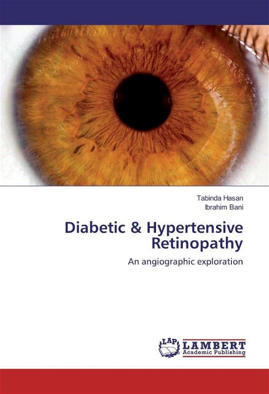 Cover for Hasan · Diabetic &amp; Hypertensive Retinopat (Book)